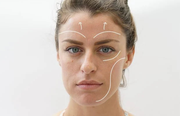 Facelifts Have Come a Long Way—Here’s What You Should Know