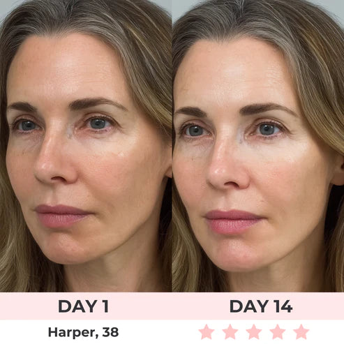 Lux Cove Red Light Under-Eye Glasses