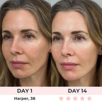 Lux Cove Red Light Under-Eye Glasses