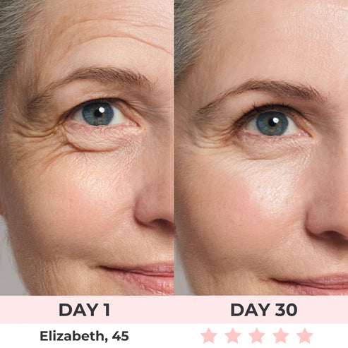 OLA™Lux Cove Red Light Under-Eye Glasses