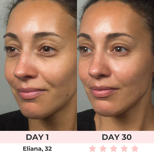 OLA™Lux Cove Red Light Under-Eye Glasses